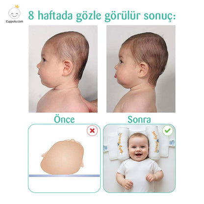 Ortopedik Bebek Düz kafa yastığı CUPPULU